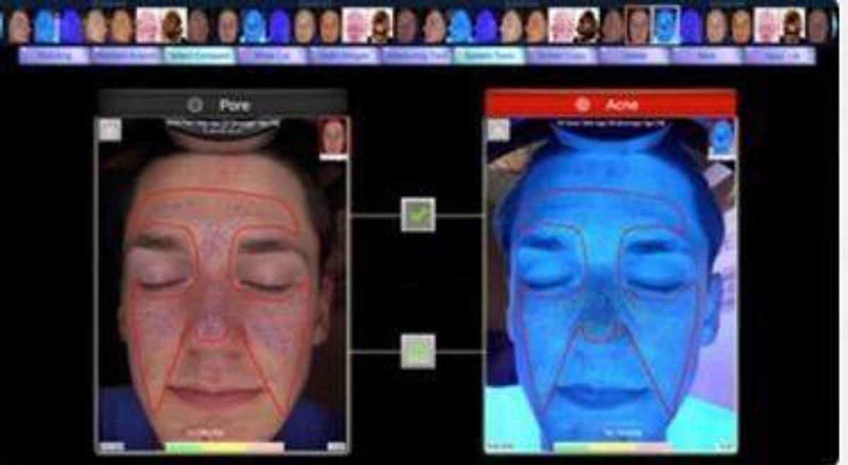 For Sale EMAGE NEW Image PRO Opera 3D Digital Skin Imaging