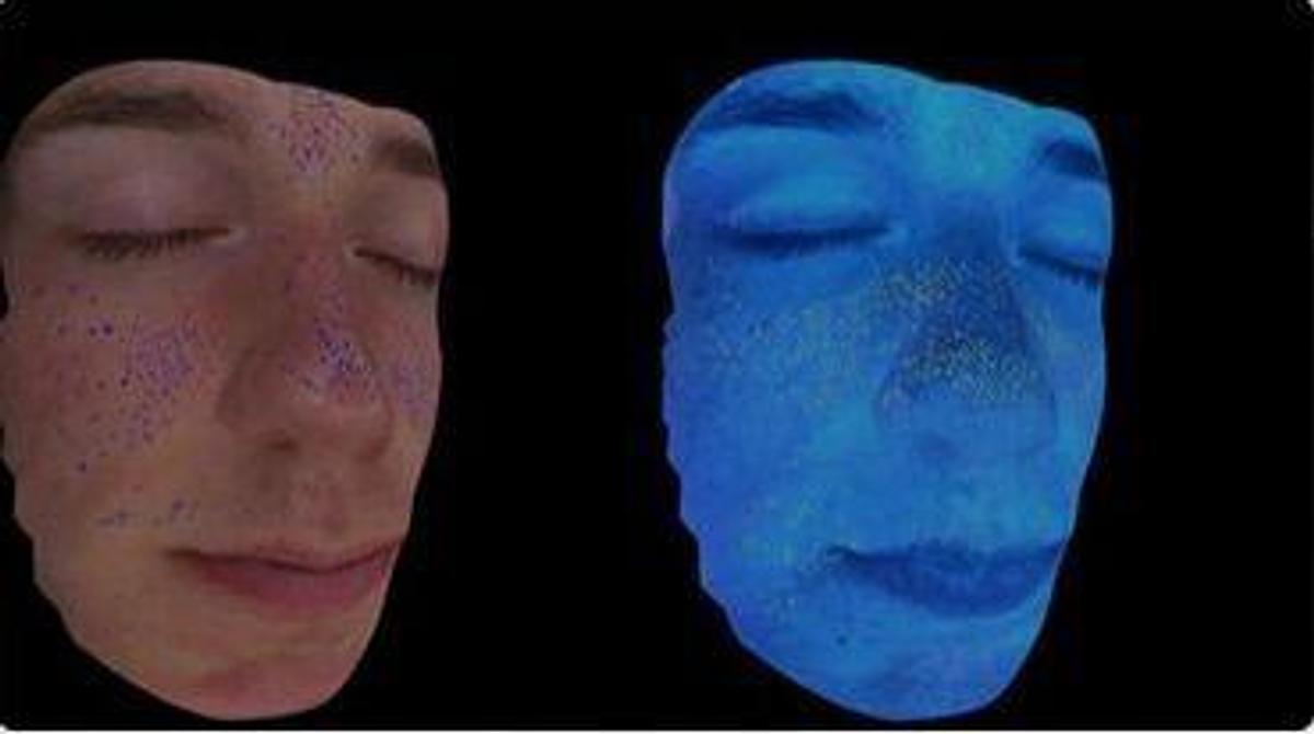 For Sale EMAGE NEW Image PRO Opera 3D Digital Skin Imaging