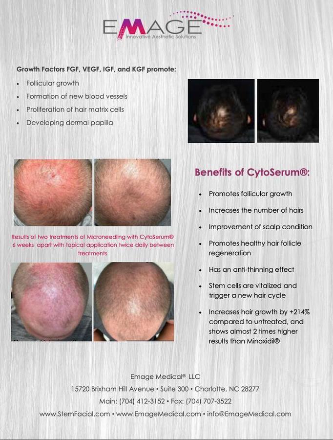 For Sale EMAGE CytoSerum Hair Restoration Product 2oz