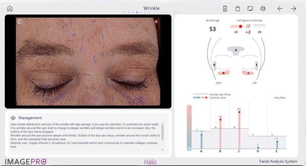 For Sale EMAGE NEW Image PRO HALO Emage Medical