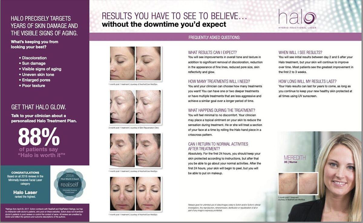 For Sale SCITON HALO Patient Education Brochure HALO (Large - Double Gate Fold)