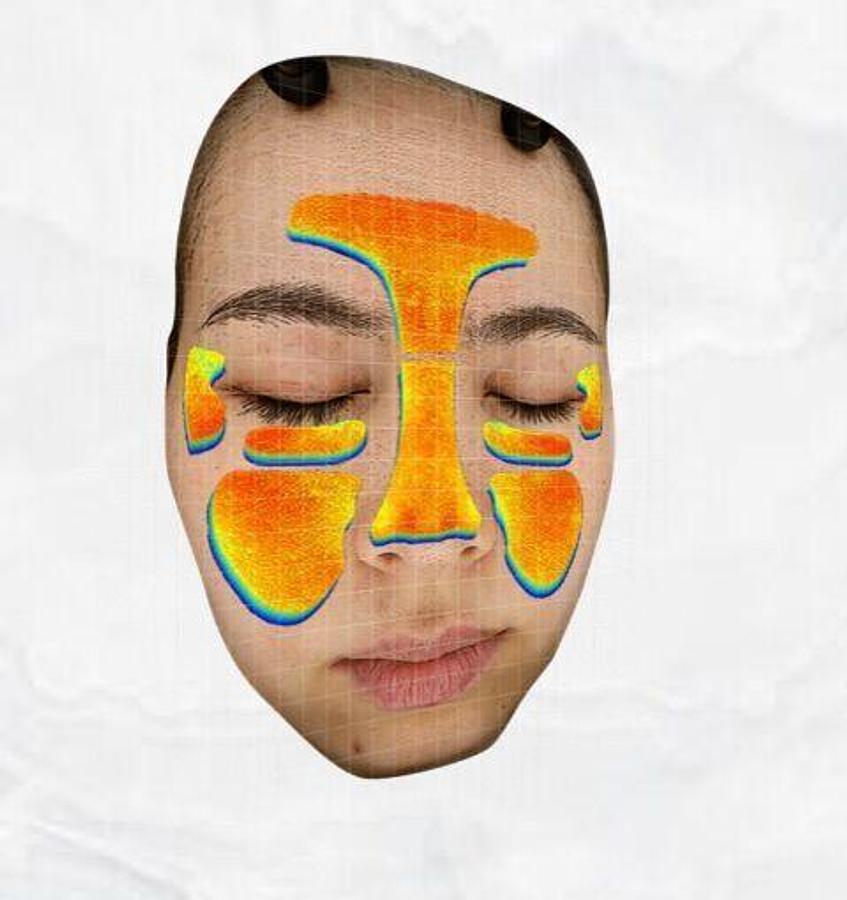 For Sale EMAGE NEW Image PRO HALO Emage Medical