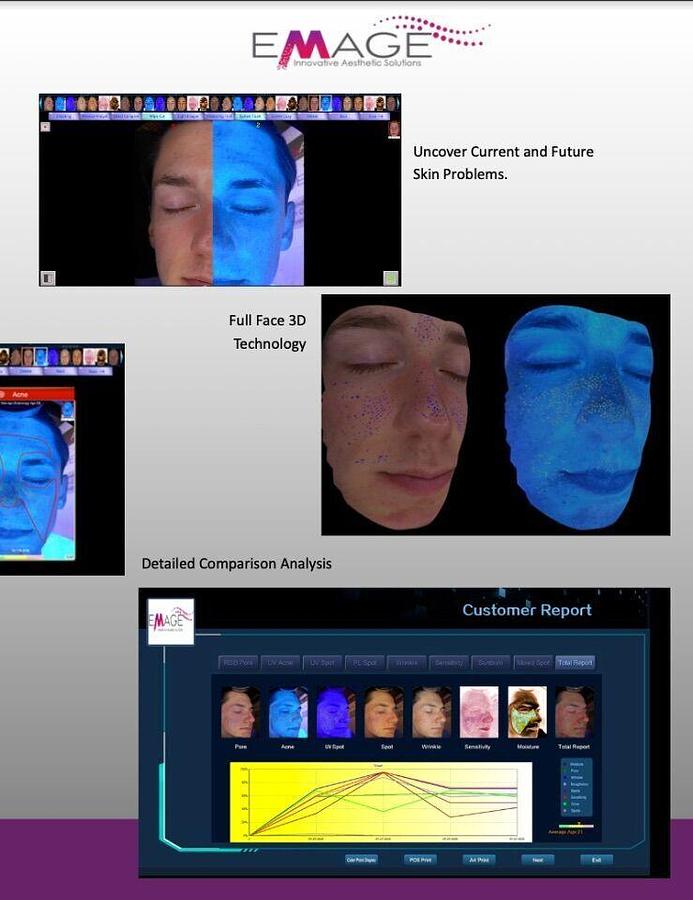 For Sale EMAGE NEW IMAGE PRO LE Skin Imaging System