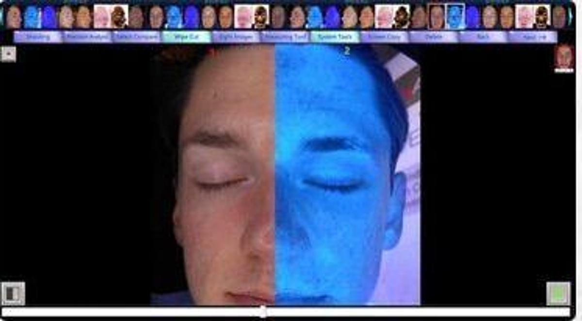 For Sale EMAGE NEW Image PRO Opera 3D Digital Skin Imaging