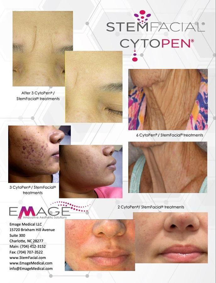 For Sale EMAGE MD StemFacial Matrix Solutions 5 per pack of 3mL Ampules (use 1 ampule per treatment)