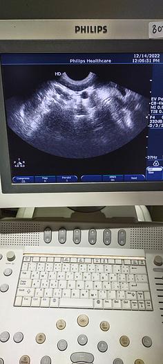 Gebraucht Philips C8-4V Transvaginal Ultraschallsonde