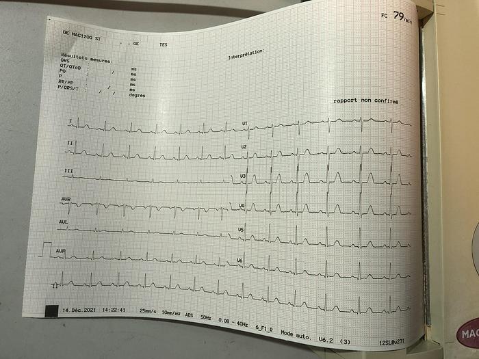 Gebraucht GE-Medical-System-EKG-8810