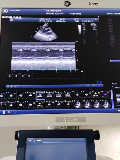 Gebraucht GE Vivid T8 Ultraschallsystem für Herz- und Gefäß-Ultraschall mit Kardio Sonde SW: R1.0.7