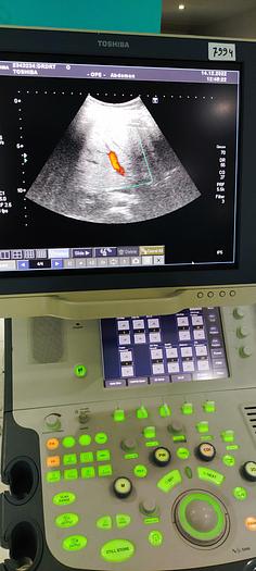 Gebraucht Toshiba PVT-375BT konvex Ultraschallsonde