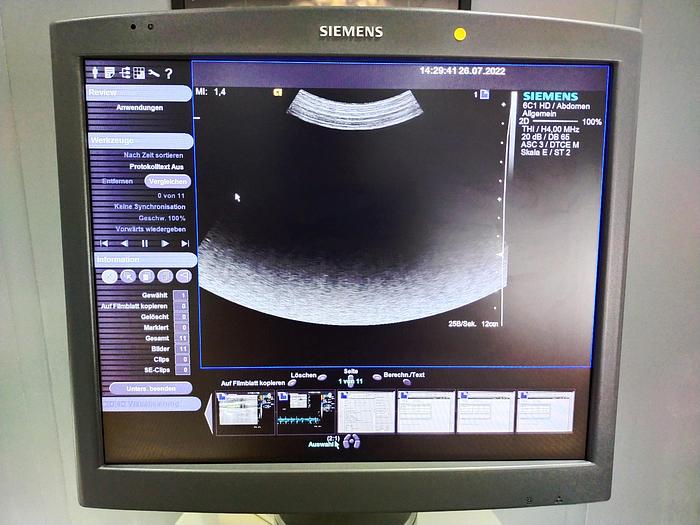 Gebraucht Siemens Acuson S2000 Ultraschallgerät mit Sonde, Drucker und DVD Brenner