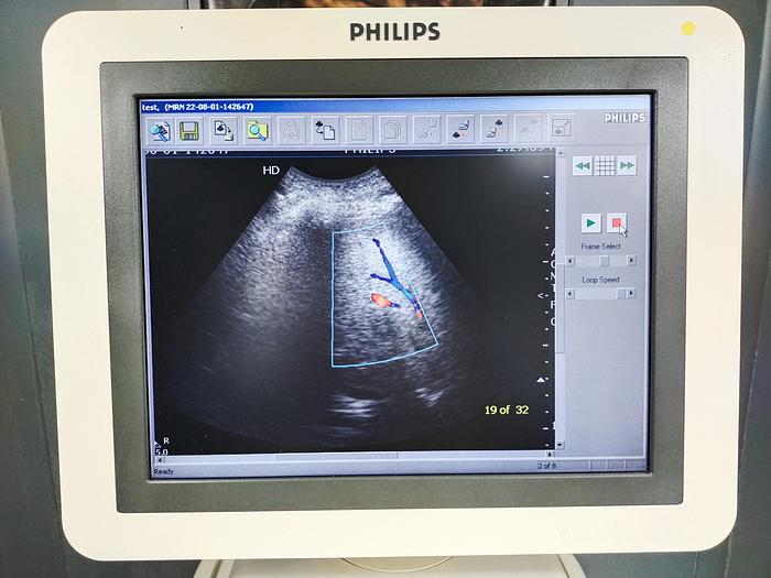 Gebraucht Philips HD7 diagnostik Ultraschallsystem mit DVD Brenner ohne Drucker SW 1.1