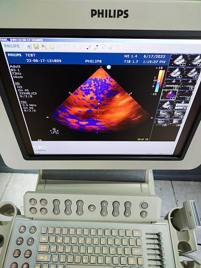 Gebraucht HD 11xe 2197 Ultraschallgerät mit 3 Sonden