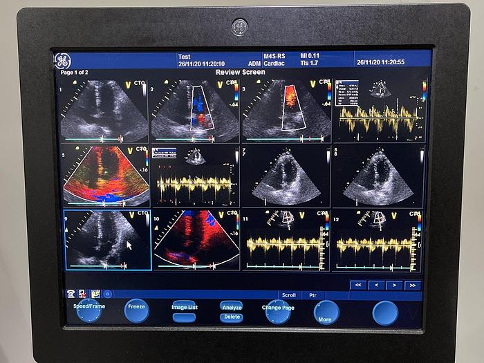 Gebraucht GE Vivid S6 Ultraschallgerät mit 2x Sonden und Sony Drucker