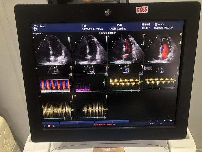 Used GE Vivid E9 Ultraschallsystem mit 2x Sonden , Sony Drucker, DVD Recorder, EKG Kabel