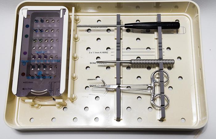 Used Nexa Orthopedics  Snap-Off Screw System
