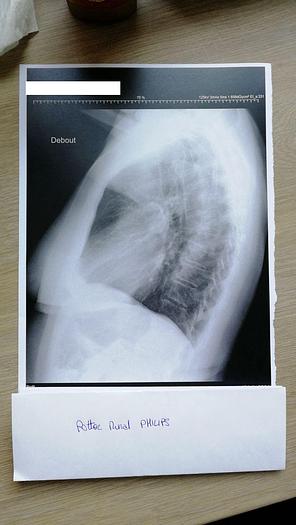 Used Digital Rad/Fluoro Room Philips Digital Diagnost TH2 VM