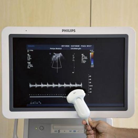 D'occasion ECHOCARDIOGRAPHE PHILIPS IU22 RADIO + CARDIO + GYNECO