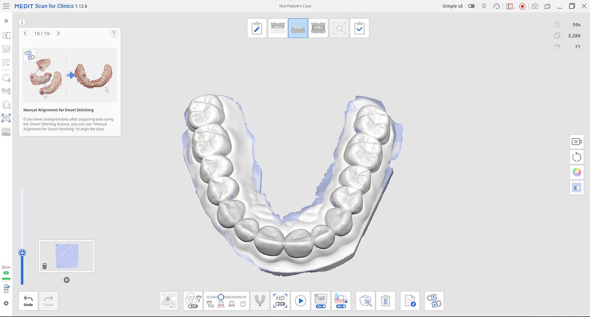 Used 2021 KAVO X700 / Medit i700 Intraoral Scanner (BD2109100215)