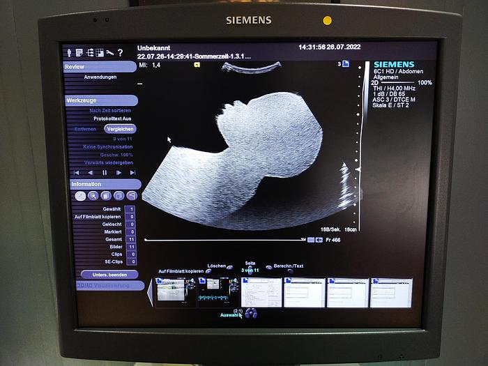 Gebraucht Siemens Acuson S2000 Ultraschallgerät mit Sonde, Drucker und DVD Brenner