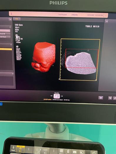 Gebraucht Philips X6-1 xMatrix 3D/4D Volumen Sektor Ultraschallsonde