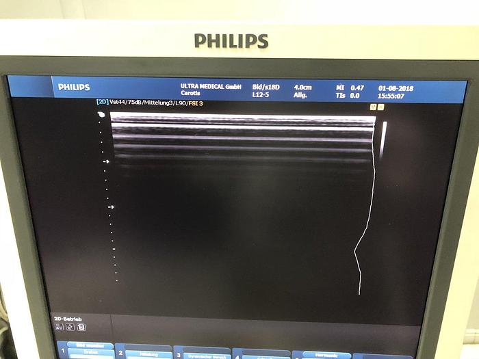 Used Philips HD9 Ultraschallgerät mit 3 Sonden 3D/4D-option