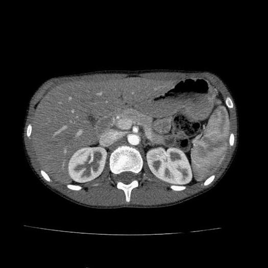 Reformado 2005 Toshiba Aquilion 64/120