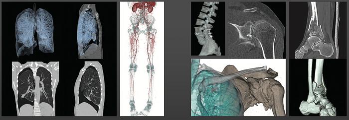 Used 2015 Toshiba Aquilion Prime