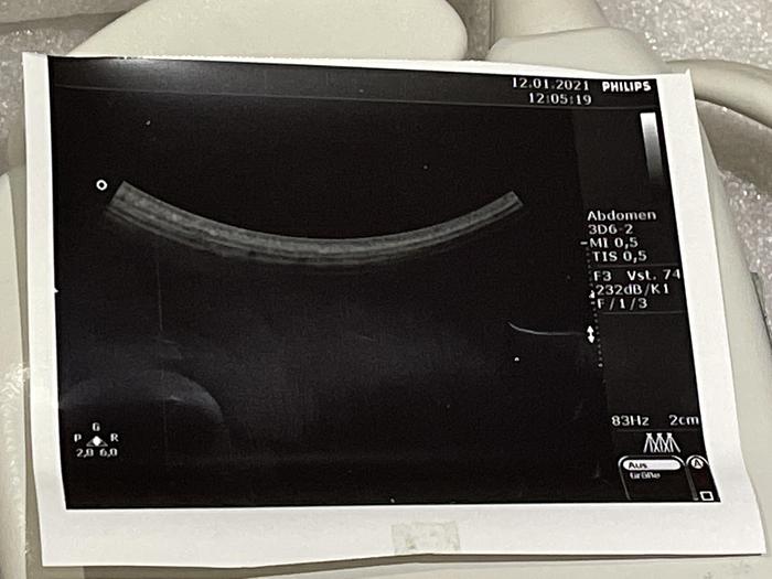 Used Philips Prob 3D6_2