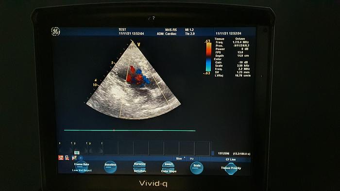 Gebraucht GE Vivid Q Ultraschallgerät