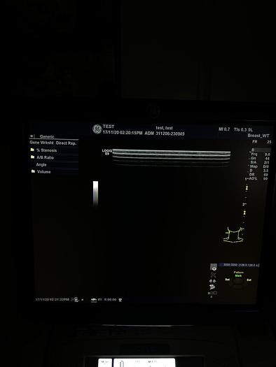 Used GE LOGIQ E9 Ultraschalgerät mit Drucker und 3 Sonden