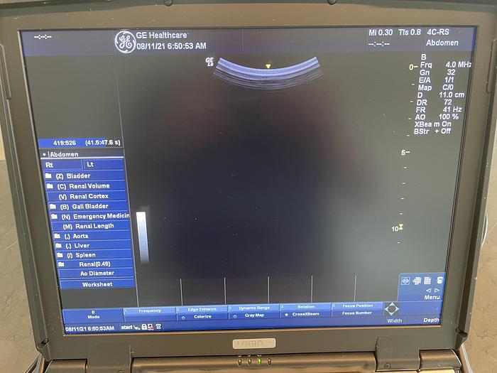 Used 2014 GE Logiq e