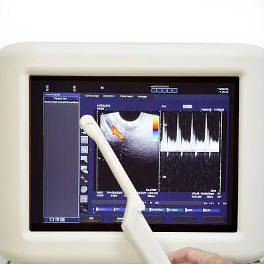 Used HITACHI PLATFORM ELITE DIGITAL COLOR DOPPLER ULTRASOUND WITH 3 PROBES