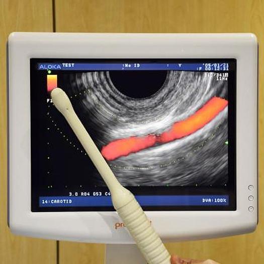 PROSOUND ULTRASOUND SCANNER ALOKA SSD-3500SX, FLAT SCREEN, 2 PROBES