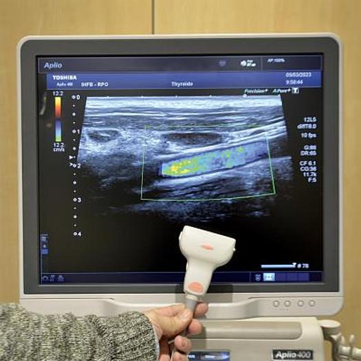 Used TOSHIBA APLIO 400 ULTRASOUND SCANNER WITH 3 PROBES