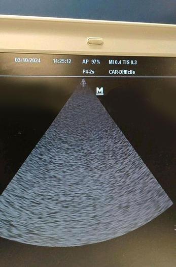 D'occasion ECHOGRAPHE PORTABLE CARDIAQUE MINDRAY M7