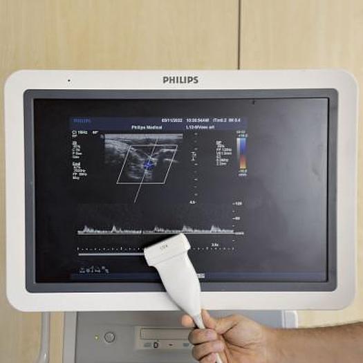 Used PHILIPS IU22 RADIO + CARDIO + GYNECO ECHOCARDIOGRAPH