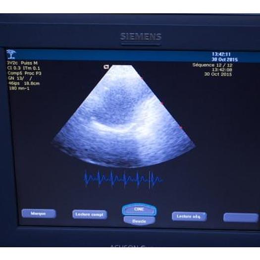 Used ACUSON SIEMENS CYPRESS COLOR PORTABLE ECHOCARDIOGRAPH WITH CART