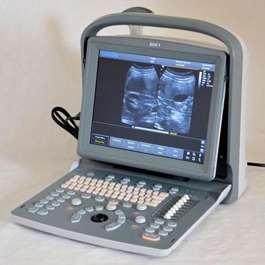 CHISON ECO1 PORTABLE ULTRASOUND WITH ABDOMINAL PROBE