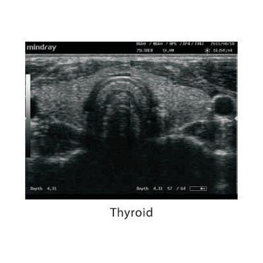 MINDRAY DP-10 ULTRASOUND SCANNER WITH LED MONITOR AND 1 CONVEX PROBE