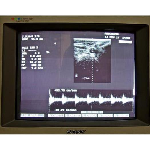 Used ESAOTE MEDICA AU4 IDEA COLOR DOPPLER ULTRASOUND SCANNER WITH 2 PROBES