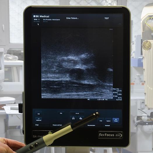 Used BK MEDICAL FLEXFOCUS 800 ULTRASOUND