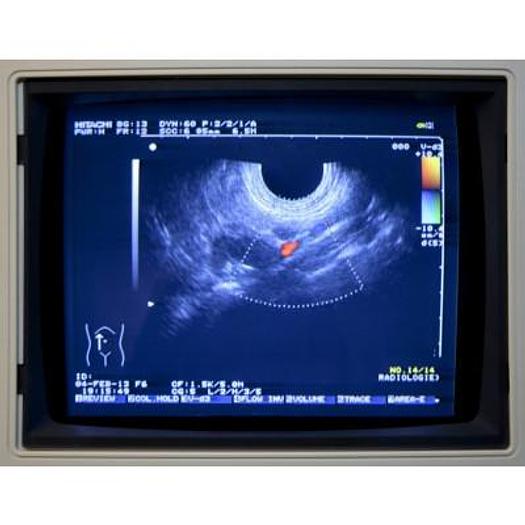 Used HITACHI EUB 525 COLOR DOPPLER ULTRASOUND SCANNER WITH 3 PROBES