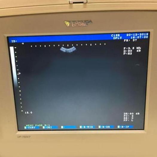 Used PORTABLE ULTRASOUND FUKUDA DENSHI JAPAN