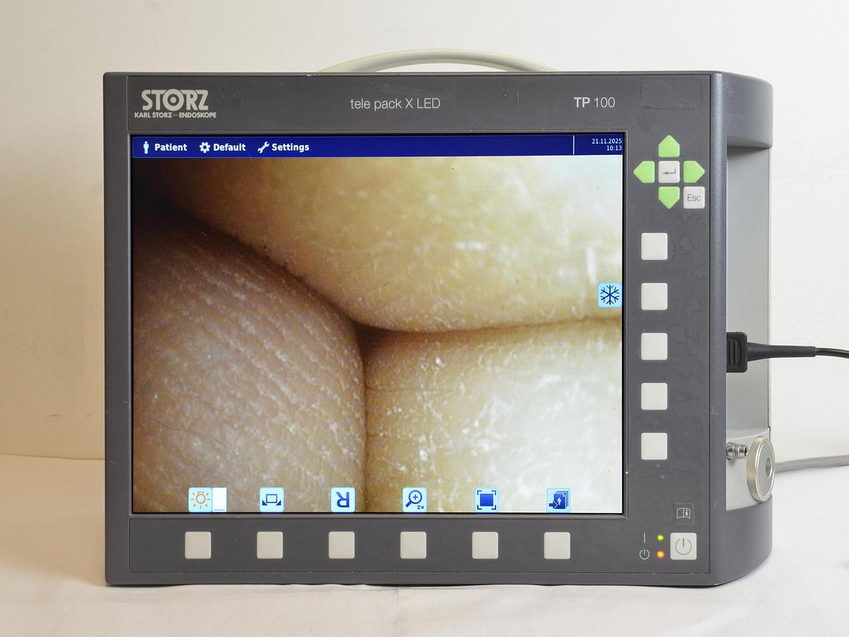 D'occasion VIDÉO-CYSTO-URÉTROSCOPE FLEXIBLE KARL STORZ 11272 VN 