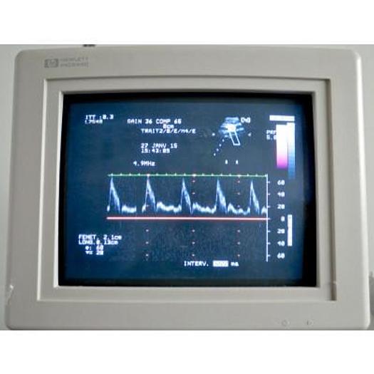 Used PHILIPS HP SONOS 5500 ECHOCARDIOGRAPH