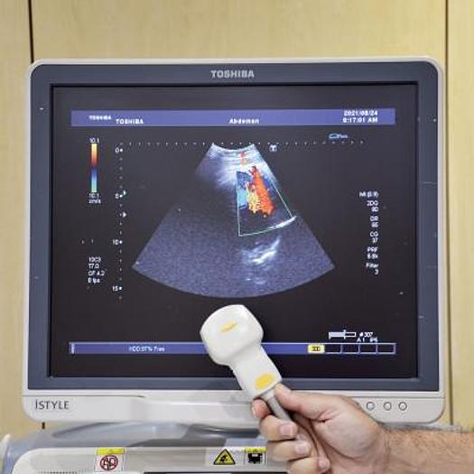 Used TOSHIBA Xario XG ultrasound scanner (SSA-680A)