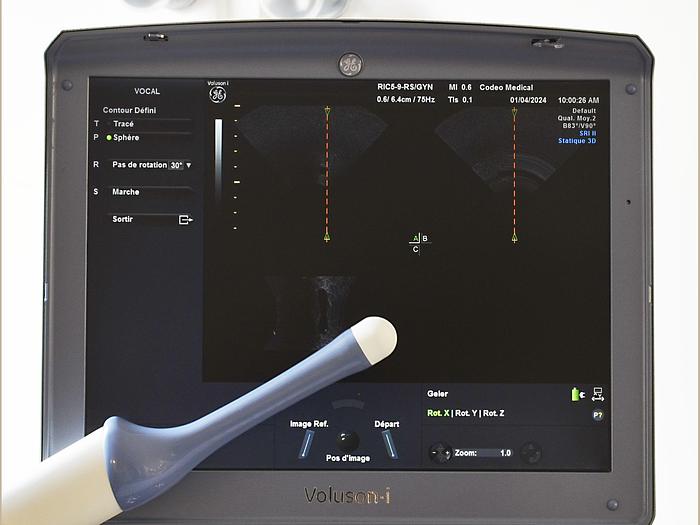 Used GENERAL ELECTRIC VOLUSON-I PORTABLE ULTRASOUND SCANNER ON CART