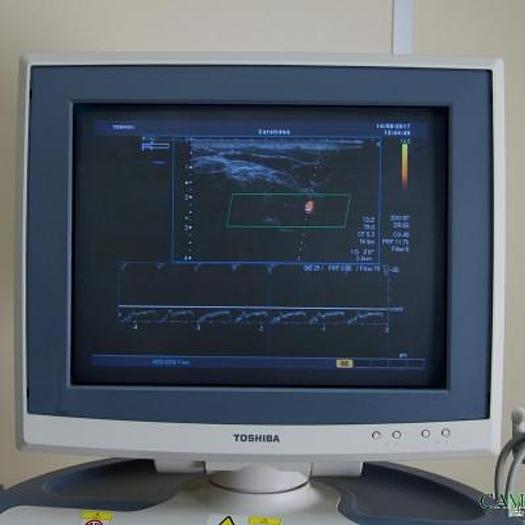 Used TOSHIBA XARIO ULTRASOUND SCANNER WITH 3 PROBES