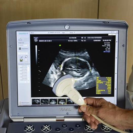 Used GENERAL ELECTRIC VOLUSON-i PORTABLE ECHOGRAPHY ON TROLLEY WITH 2 CONVEXAL AND ENDOVAGINAL PROBES