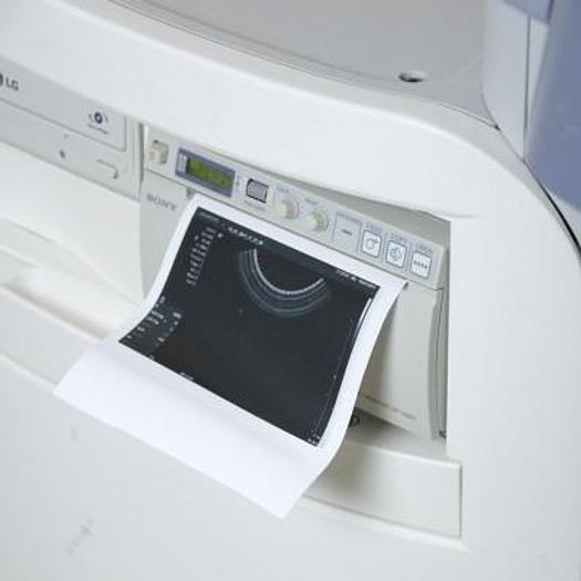 Used SIEMENS ACUSON X150 ULTRASOUND SCANNER WITH 3 PROBES AND FLAT SCREEN